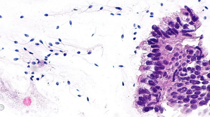 Racial Bias Represented By Cells